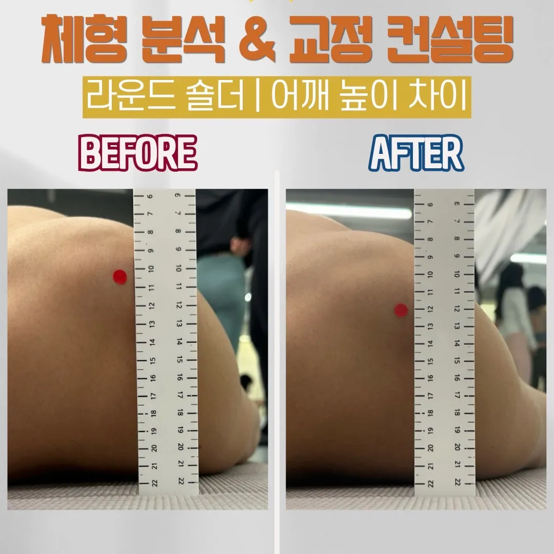 이미지 6