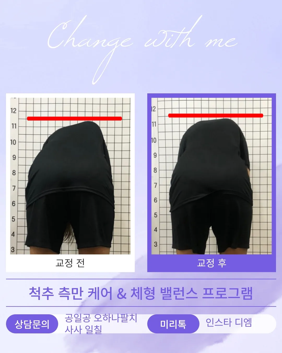 이미지 15