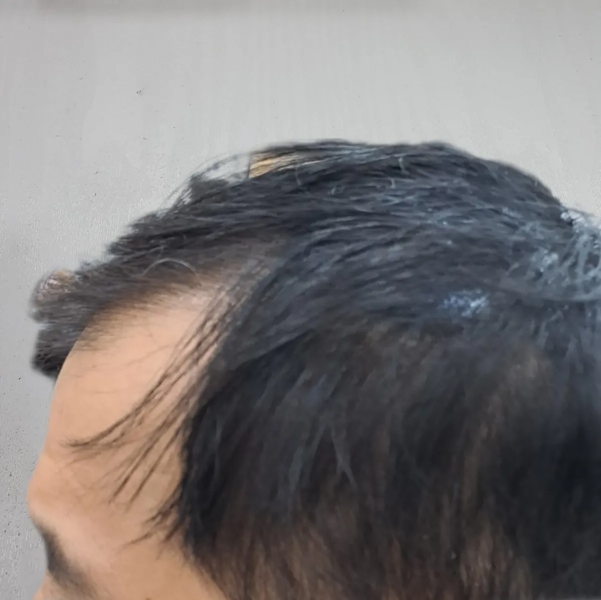 이미지 3