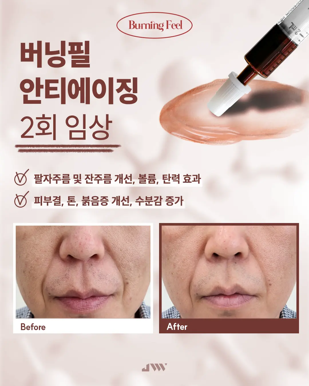 이미지 4