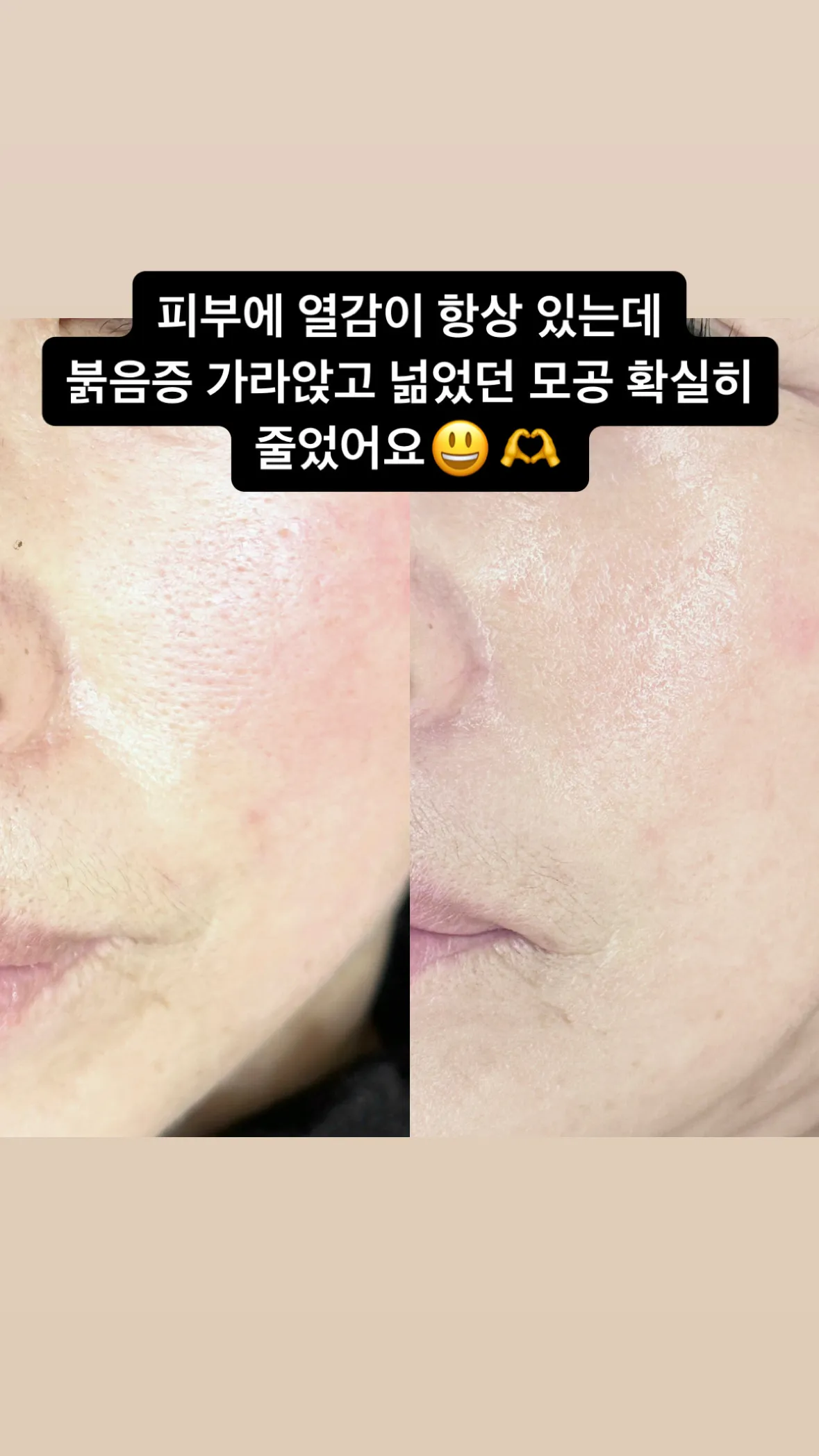 이미지 9