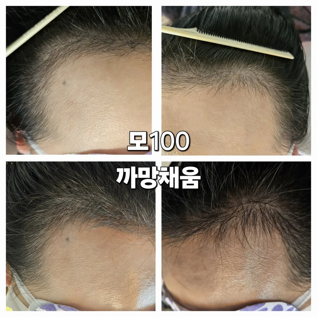 이미지 8