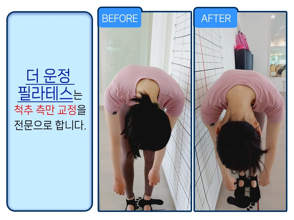 이미지 11
