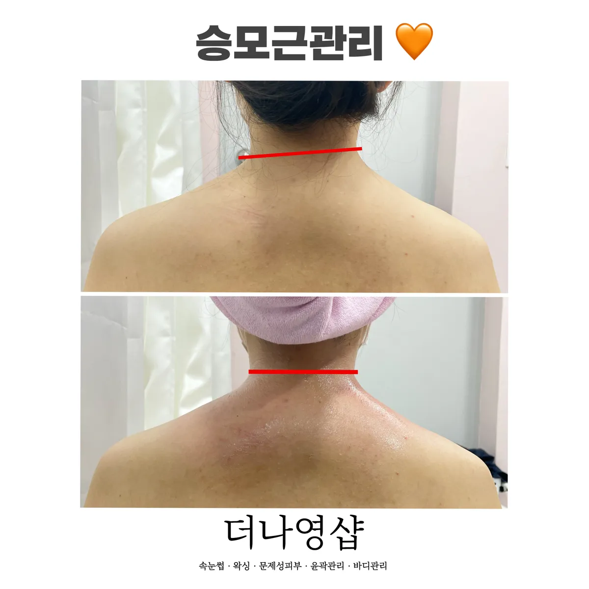 이미지 7