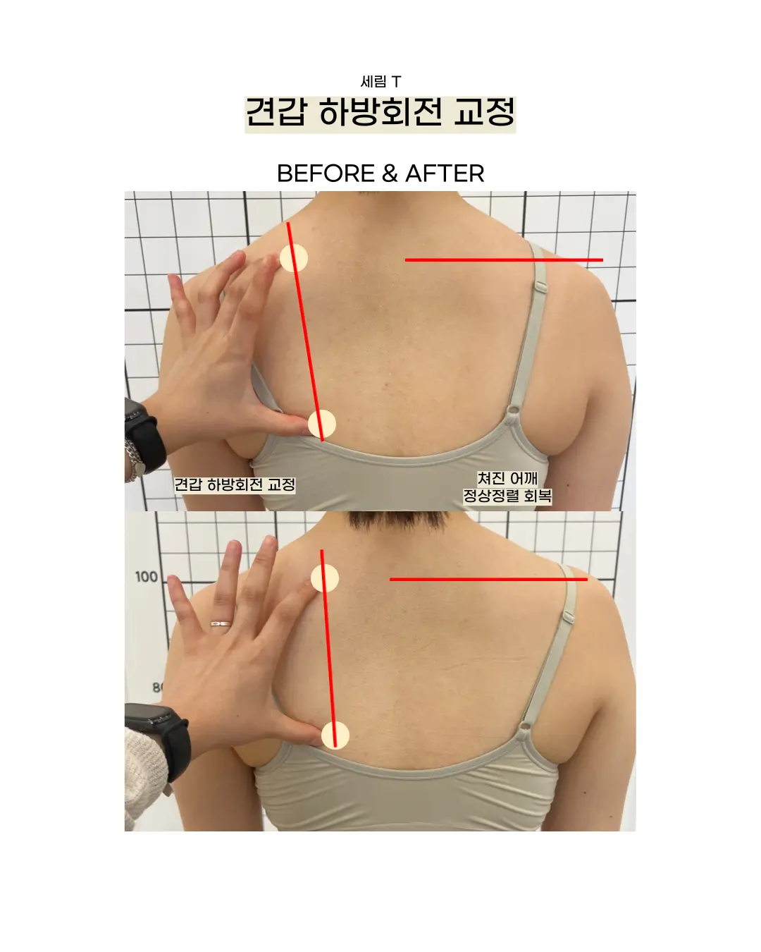 이미지 4