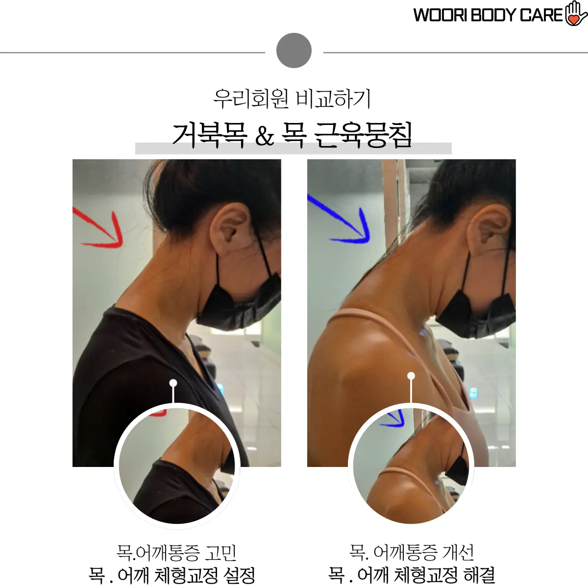 이미지 6
