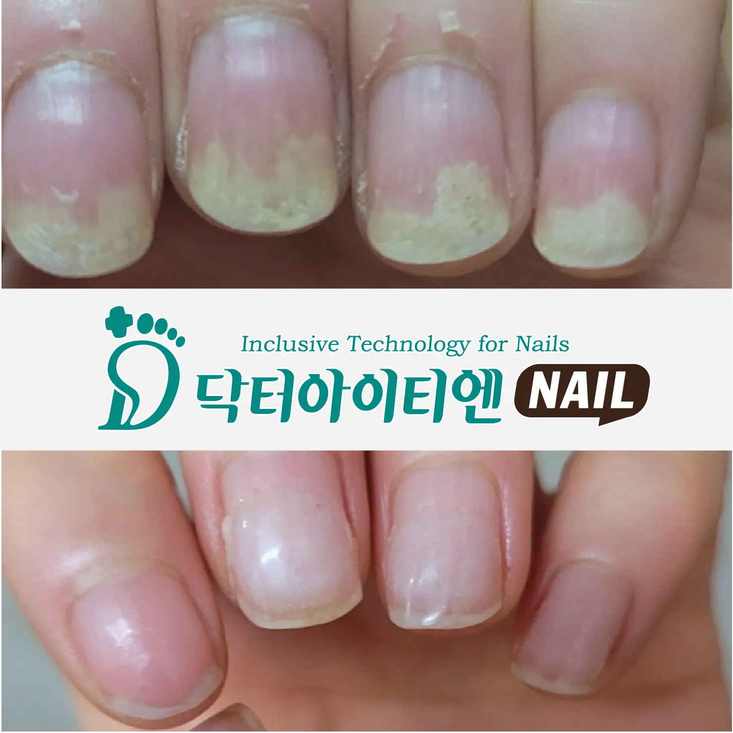 이미지 11