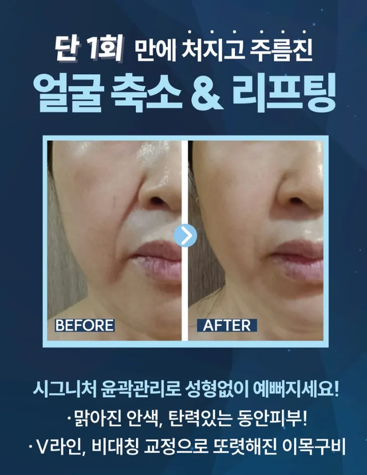 이미지 3