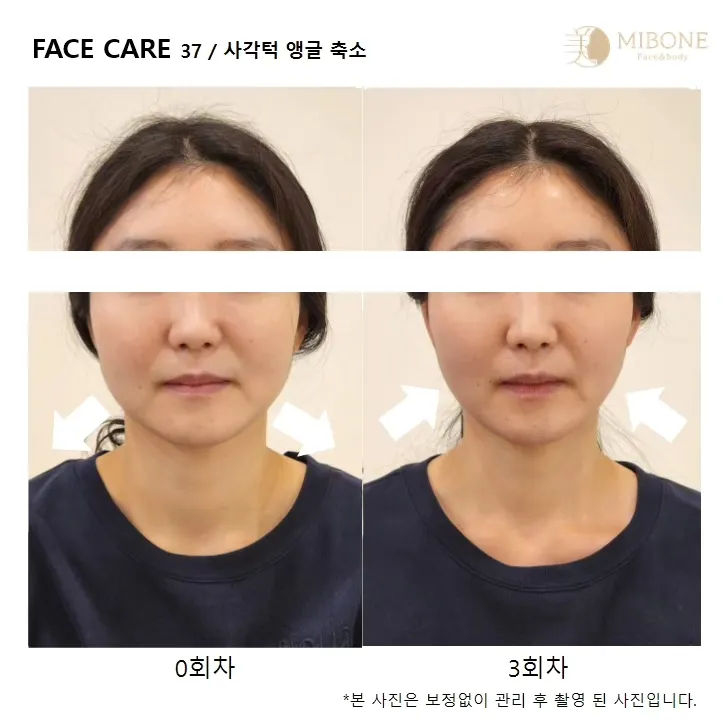 이미지 10