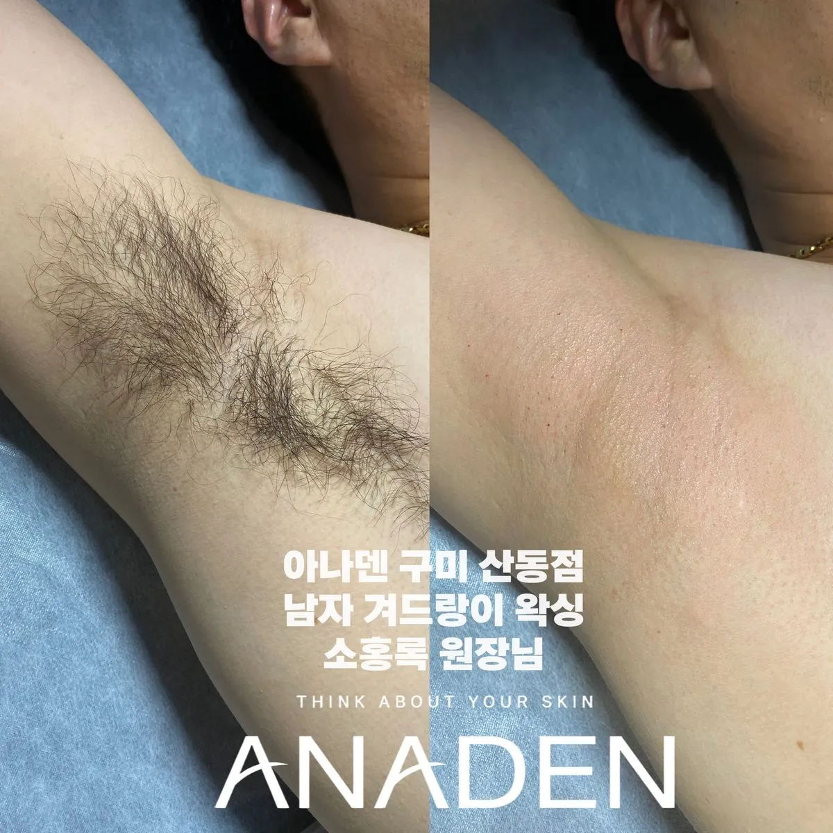 이미지 5