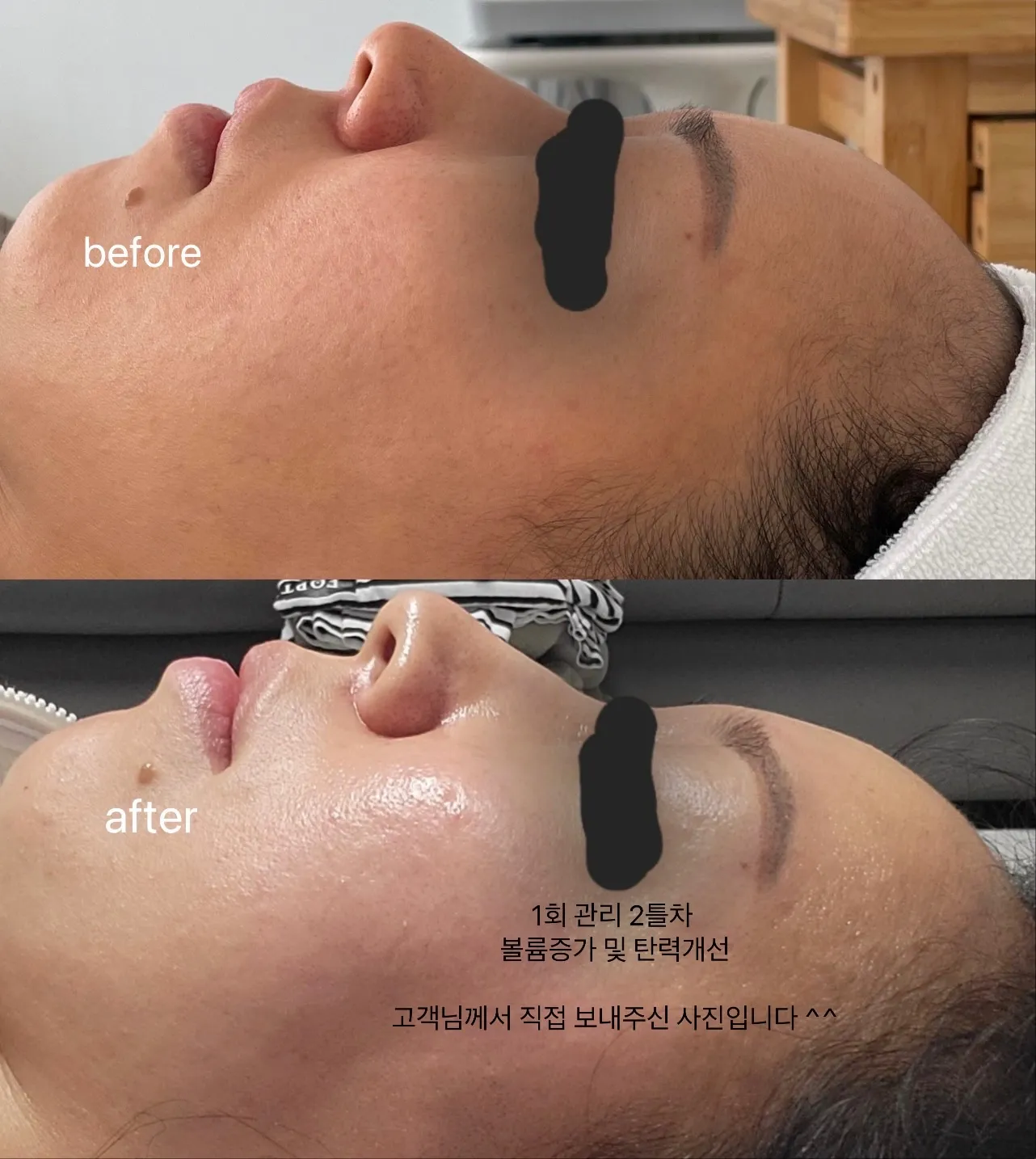 이미지 3