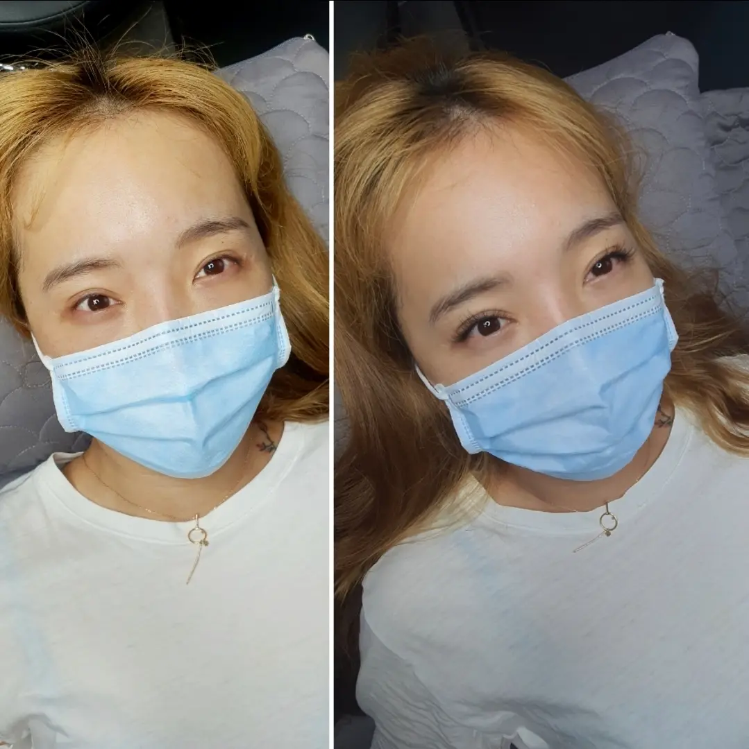 이미지 3