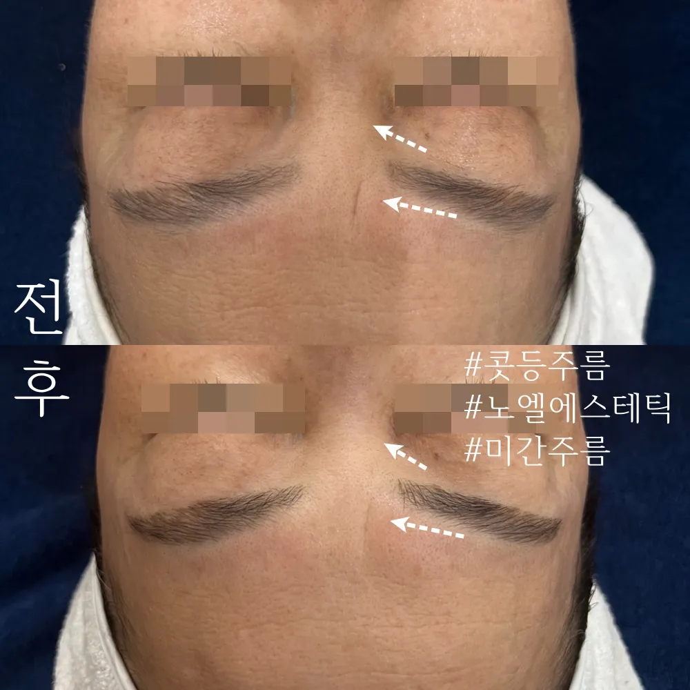 이미지 9