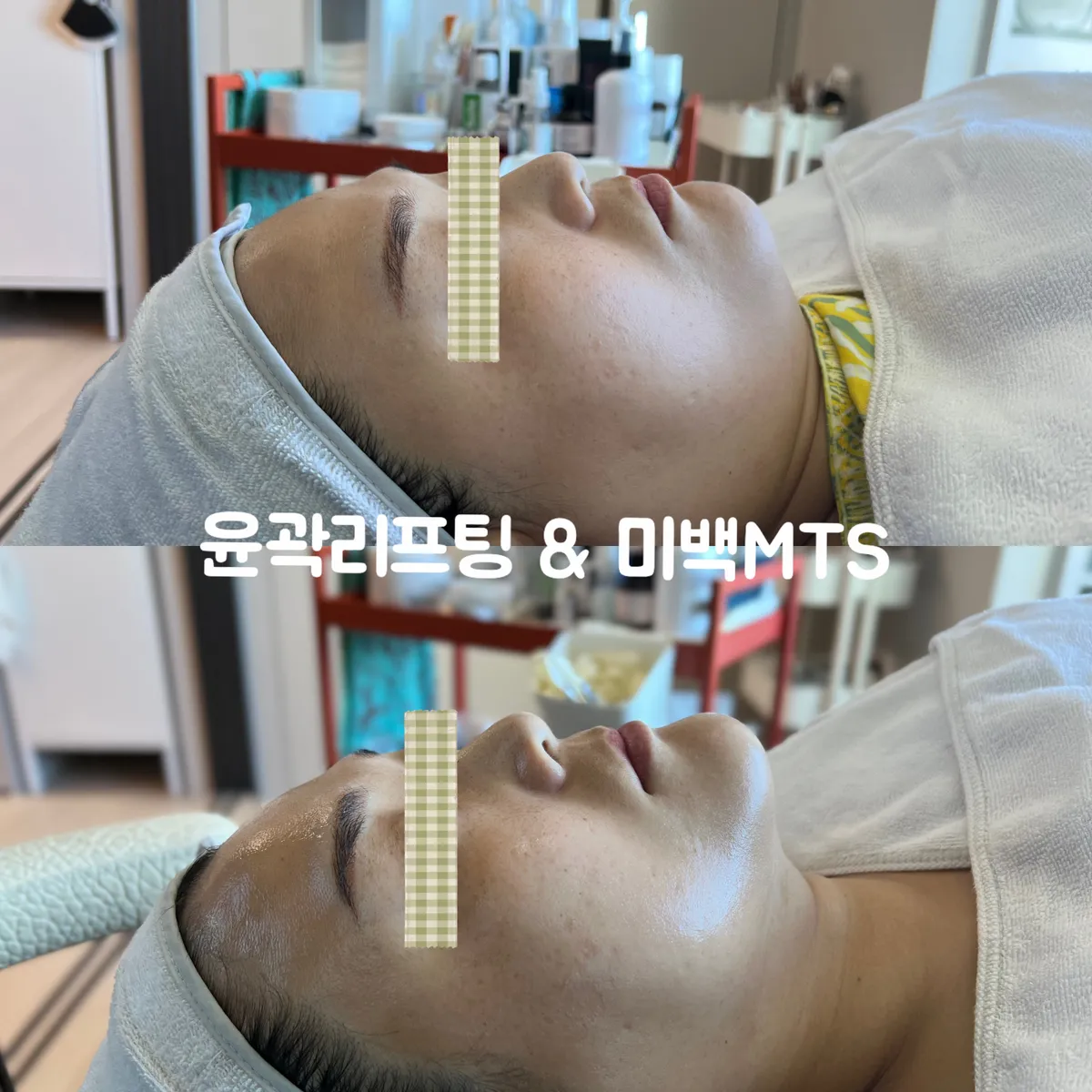 이미지 8