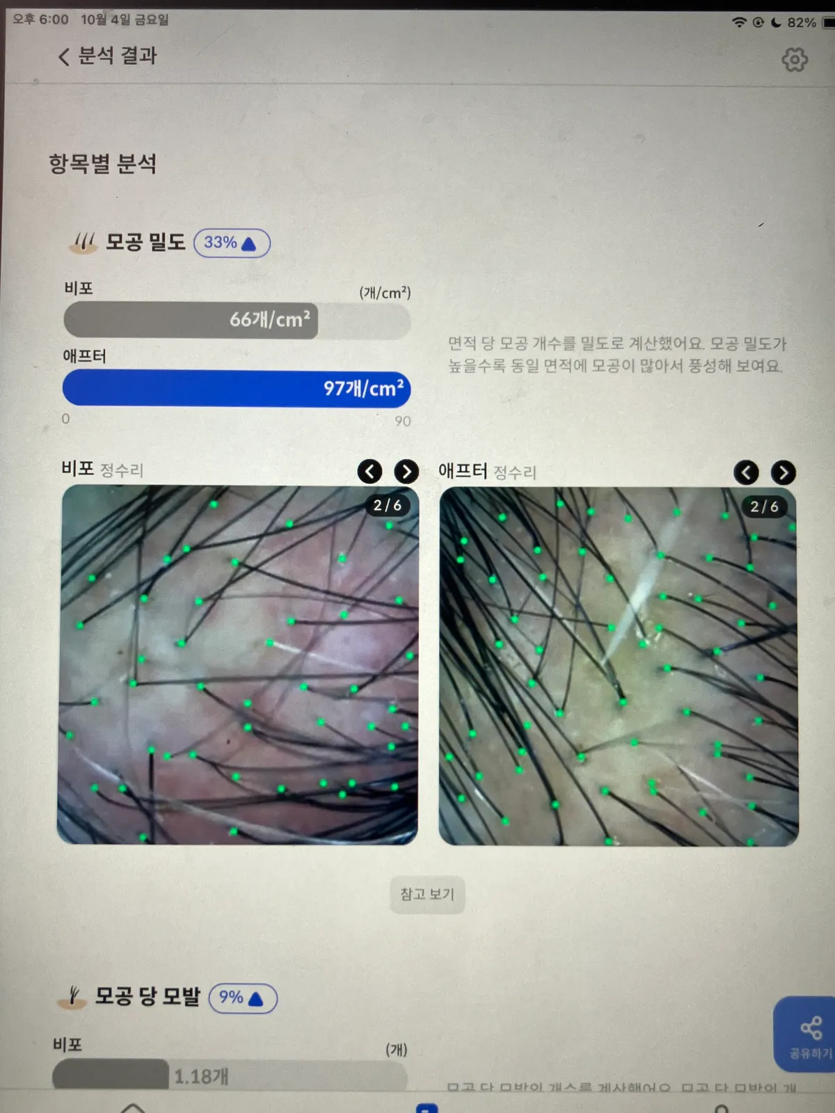이미지 5