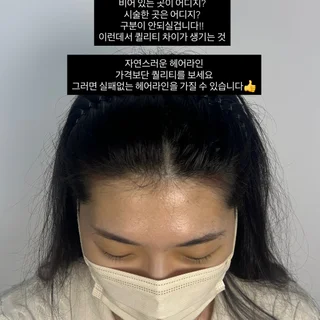 여성 헤어라인