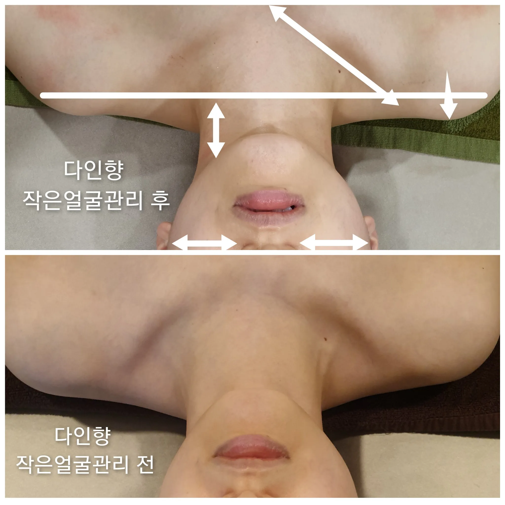 이미지 5