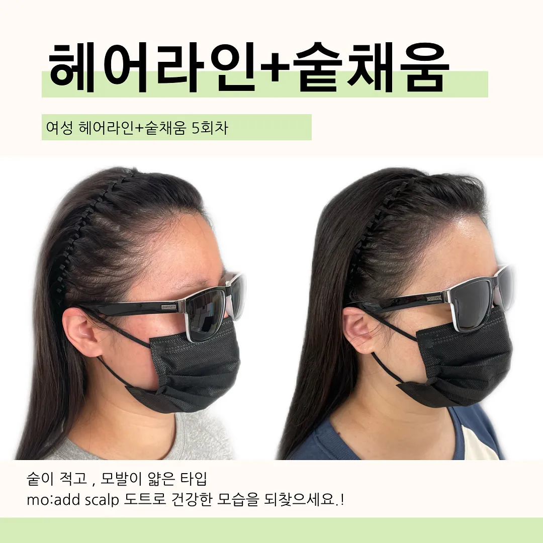 이미지 6