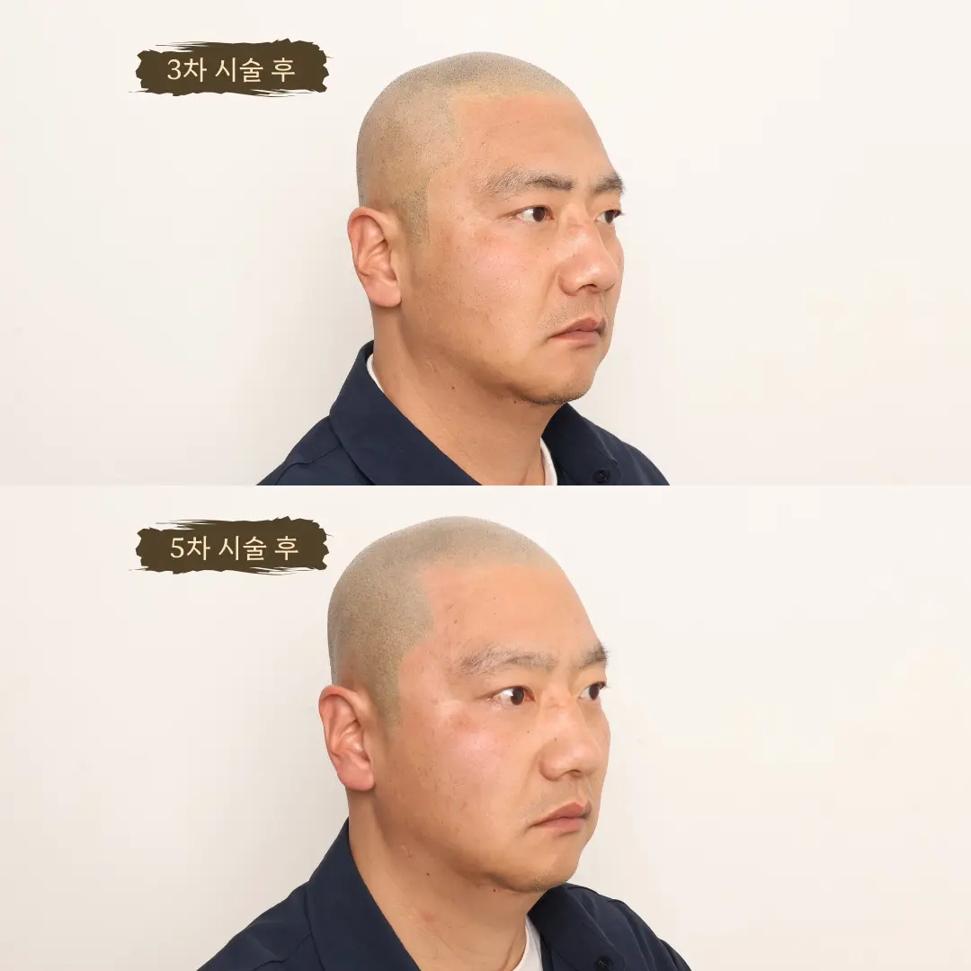 이미지 18