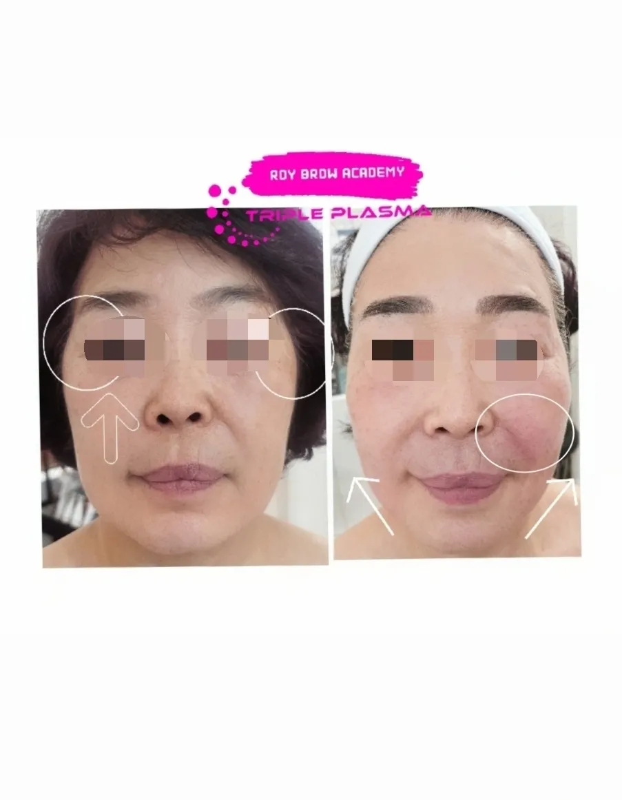 이미지 5
