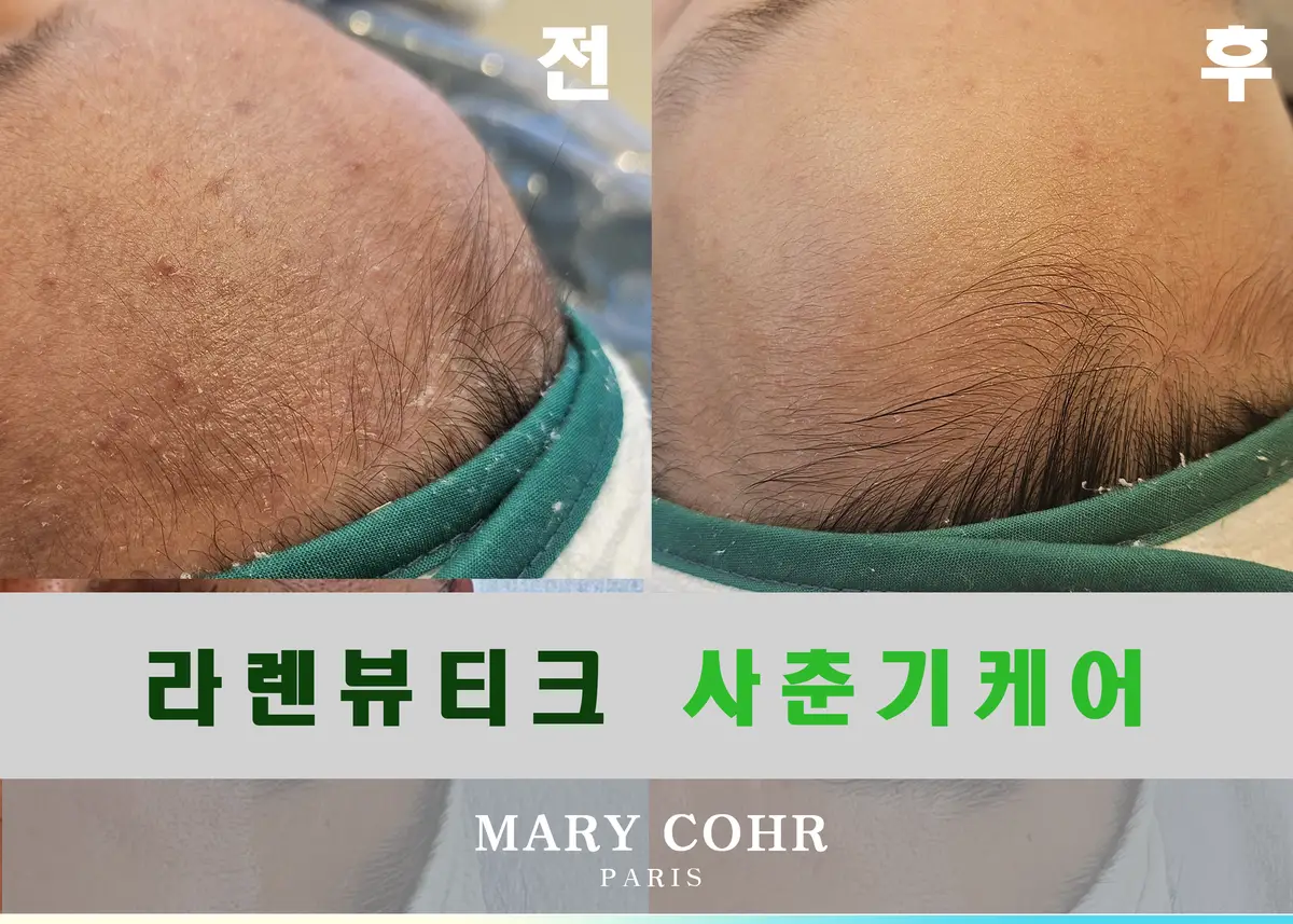이미지 9