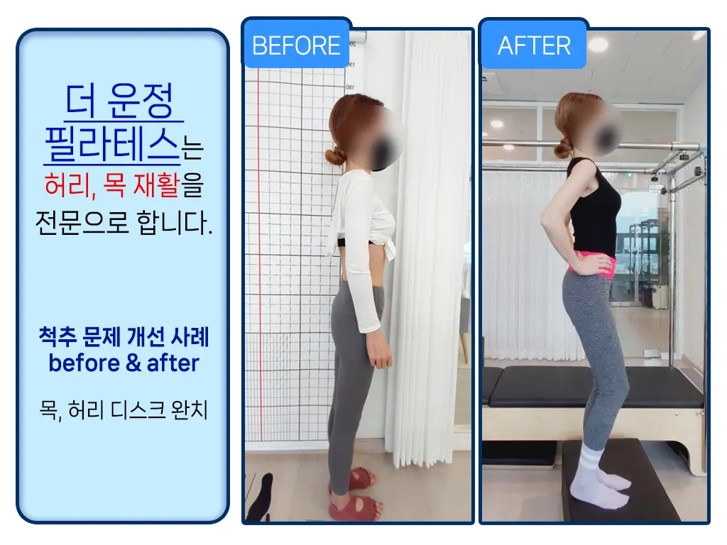 이미지 7