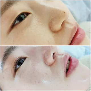 원래 까만사람은 없었다.(미백케어)