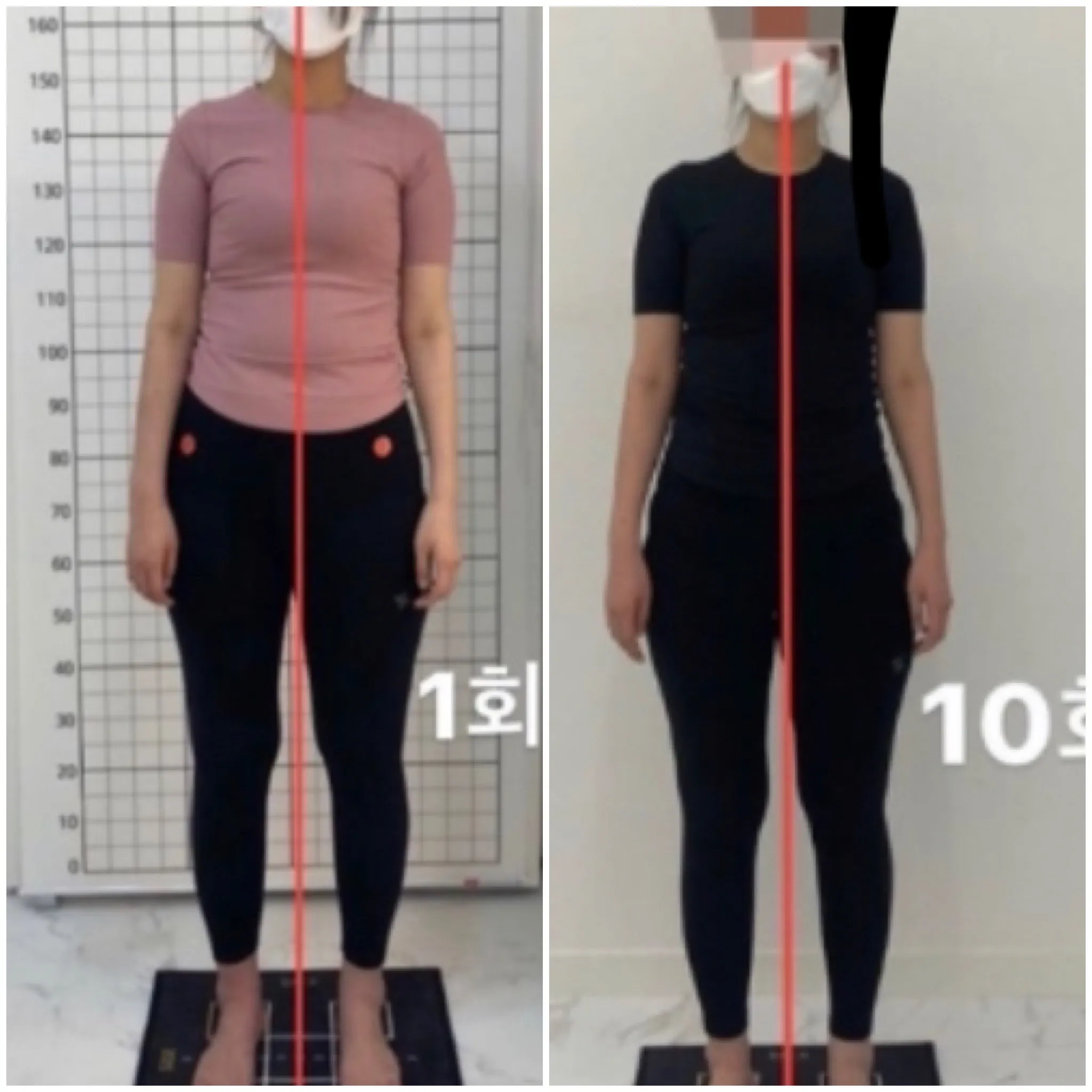 체형 교정 / 박윤서 - 숨고, 숨은고수 체형 교정 