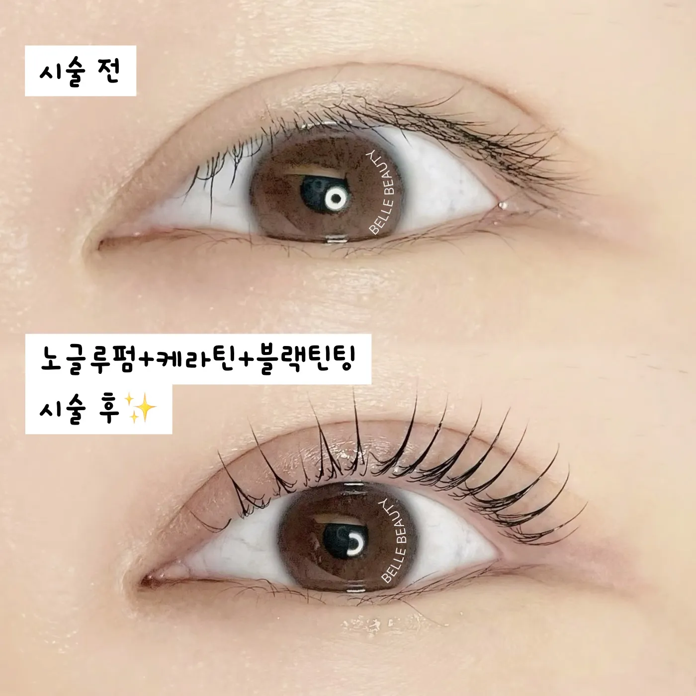 이미지 8