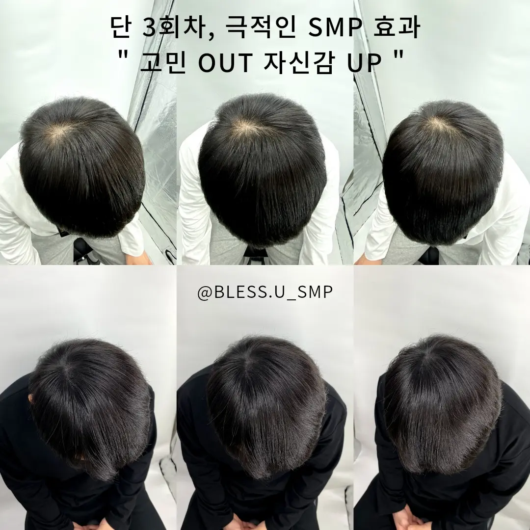 이미지 9