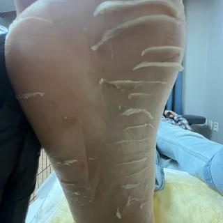 문제성발관리