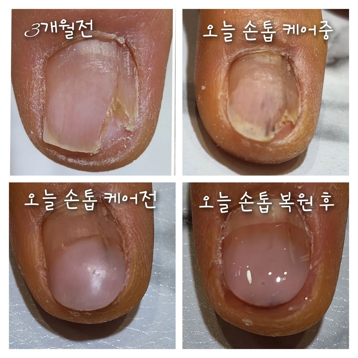 이미지 6