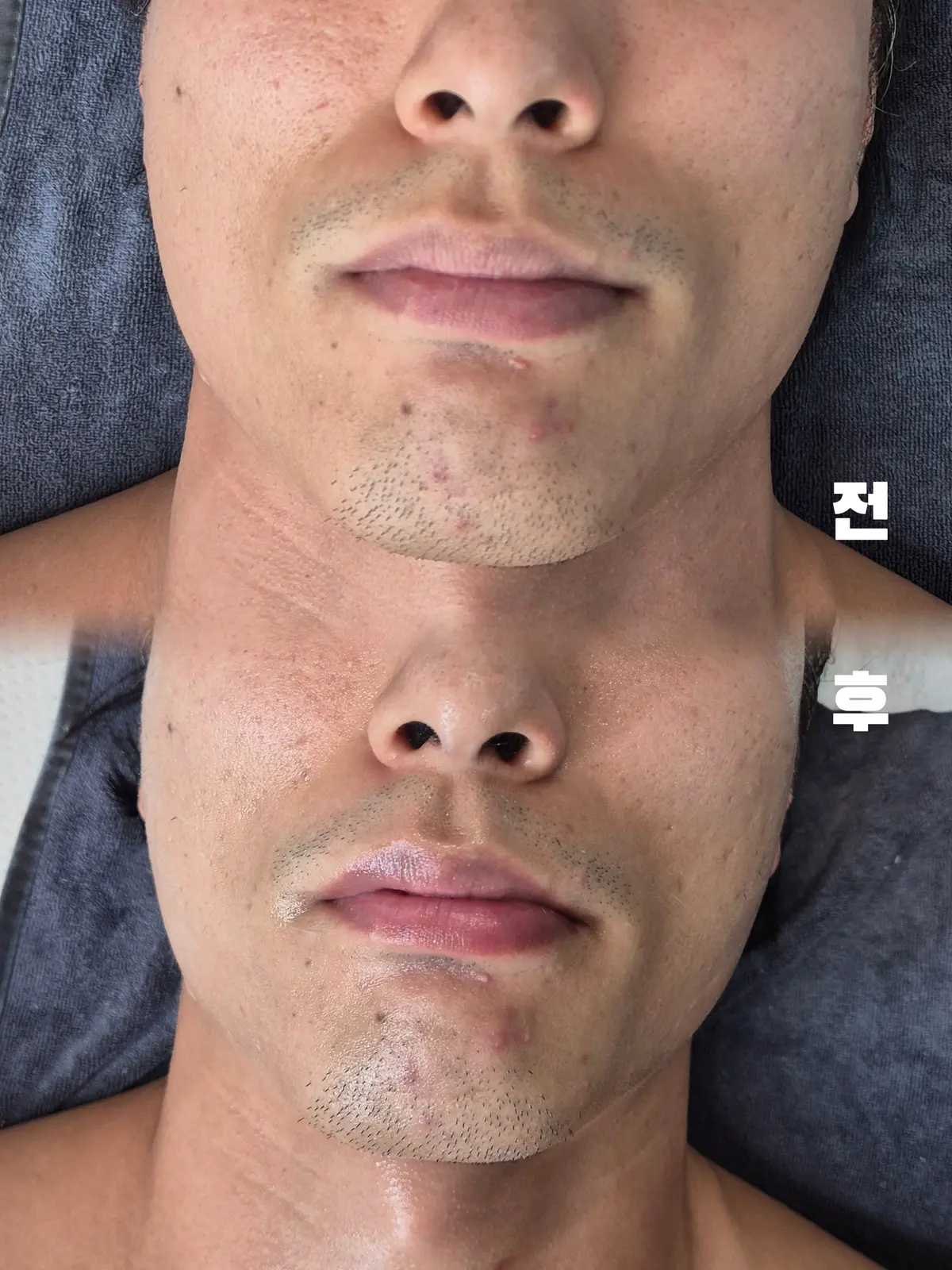 이미지 5
