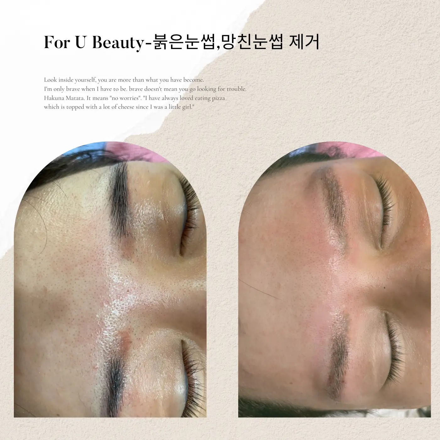 이미지 7