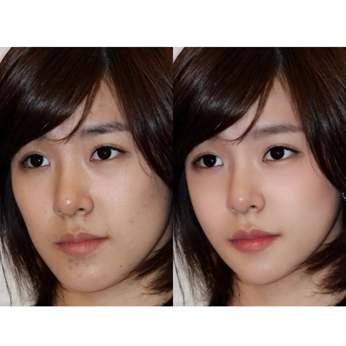 이미지 2
