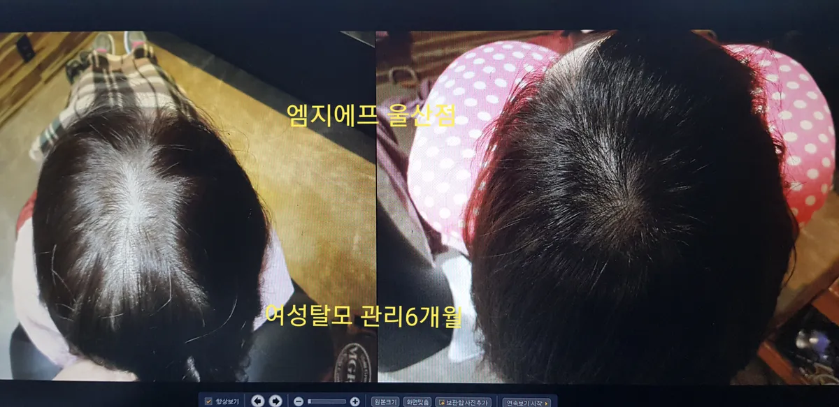 이미지 7