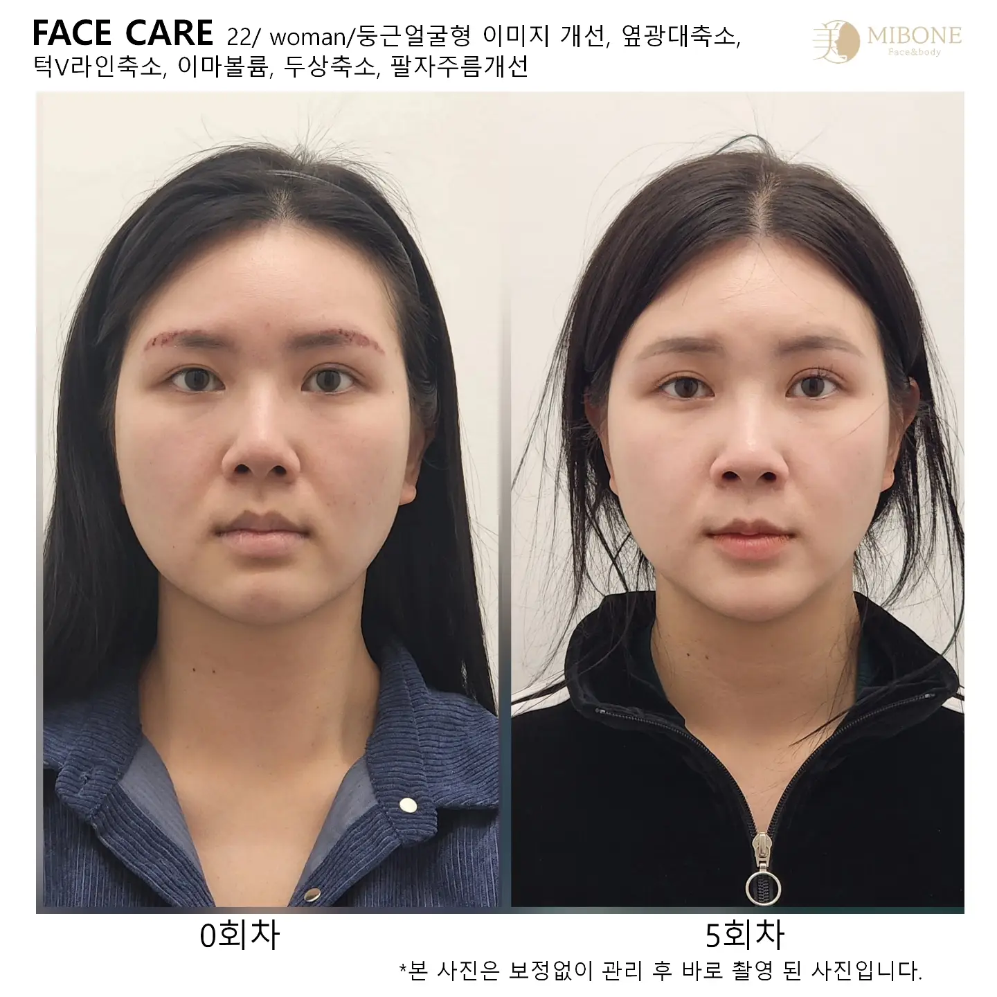 이미지 7