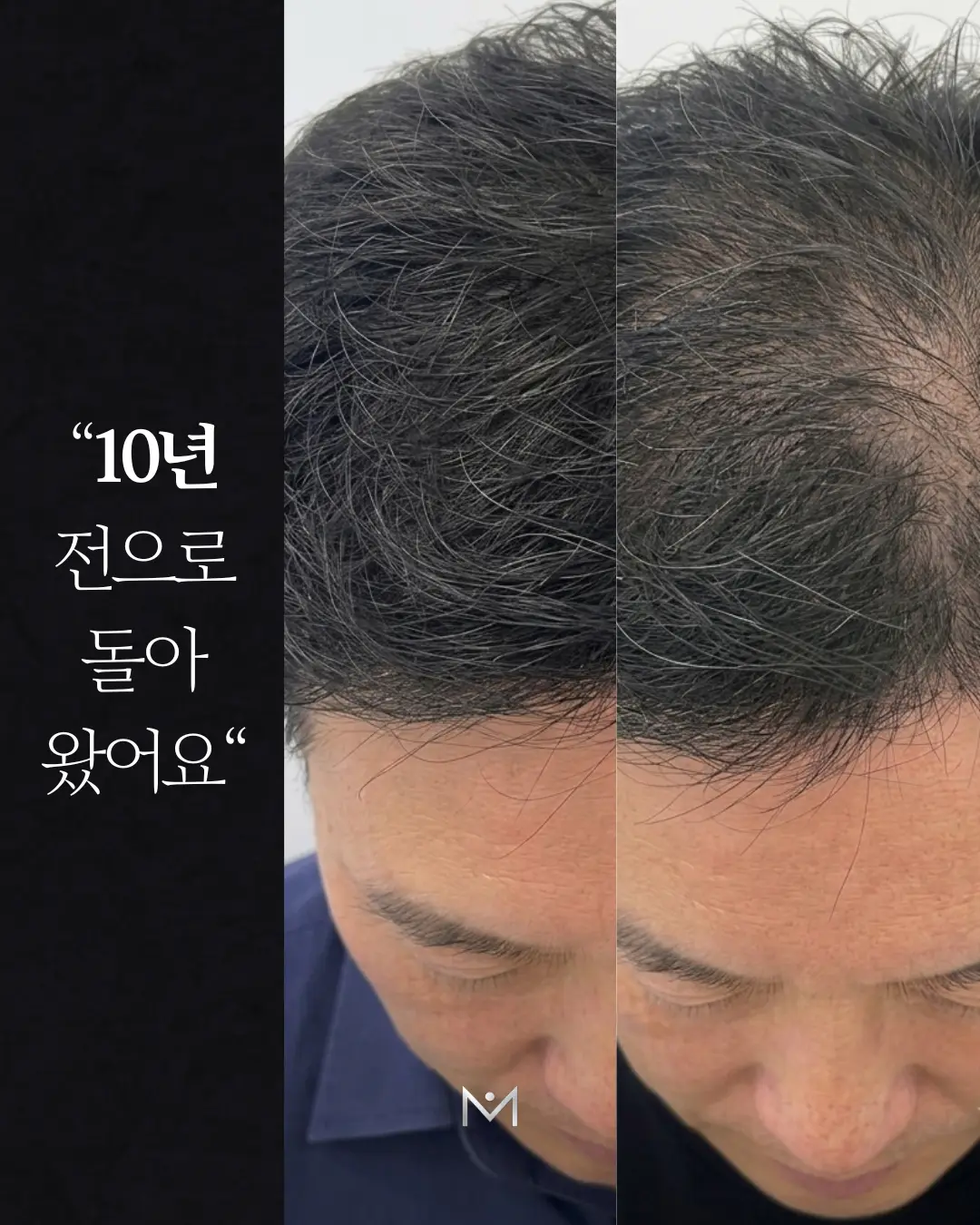 이미지 8