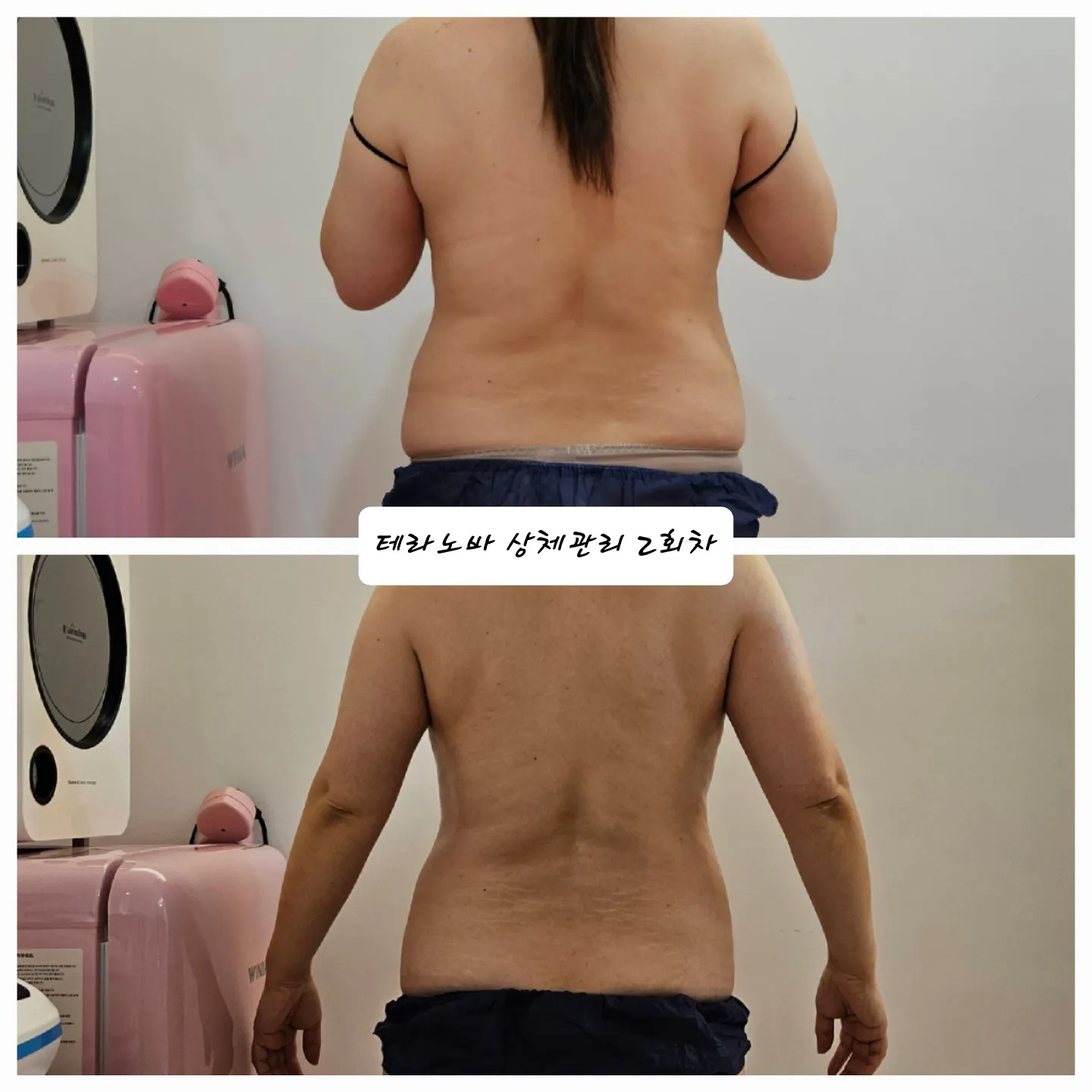 이미지 5