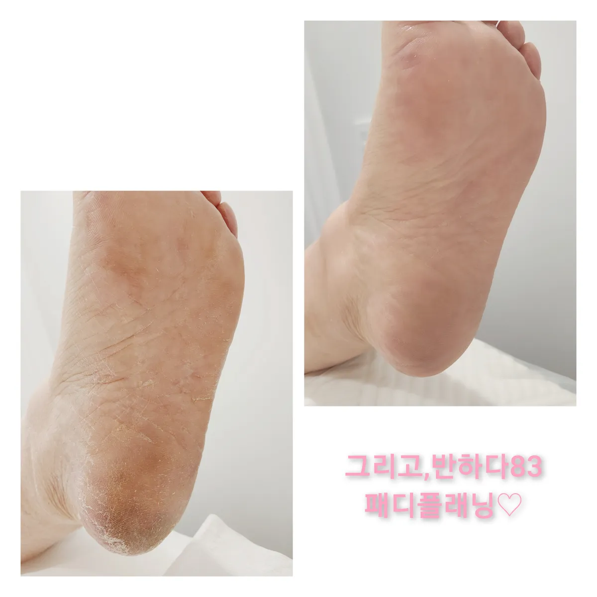 이미지 8