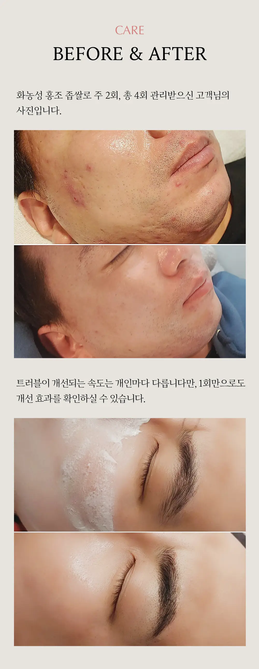이미지 5