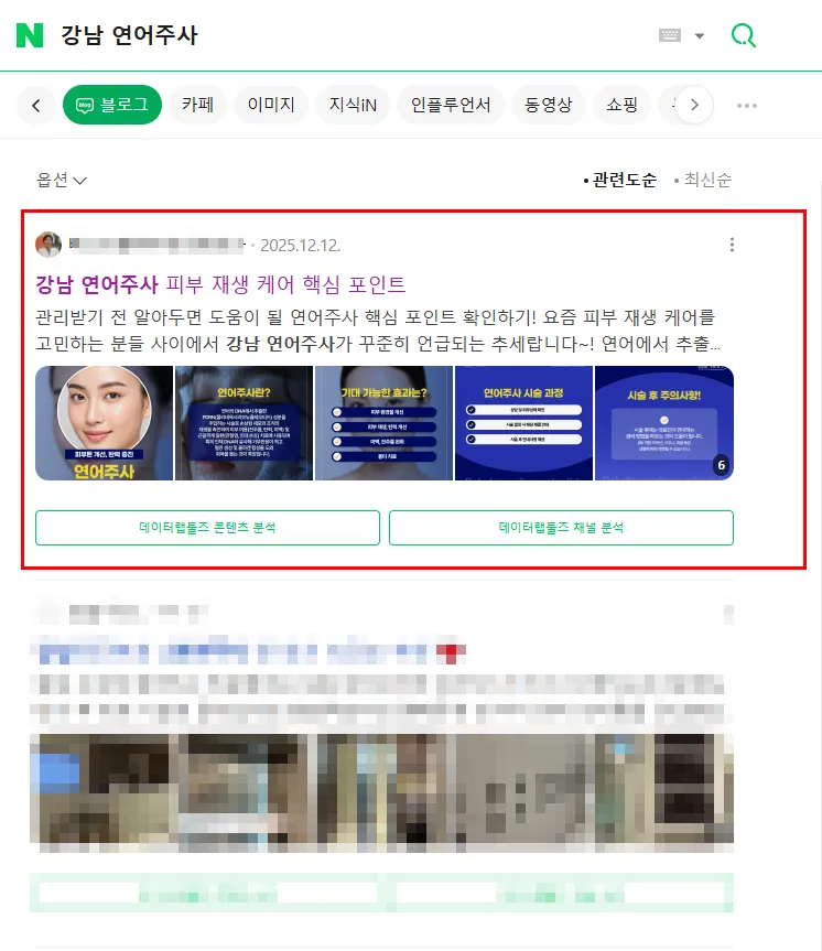 이미지 2