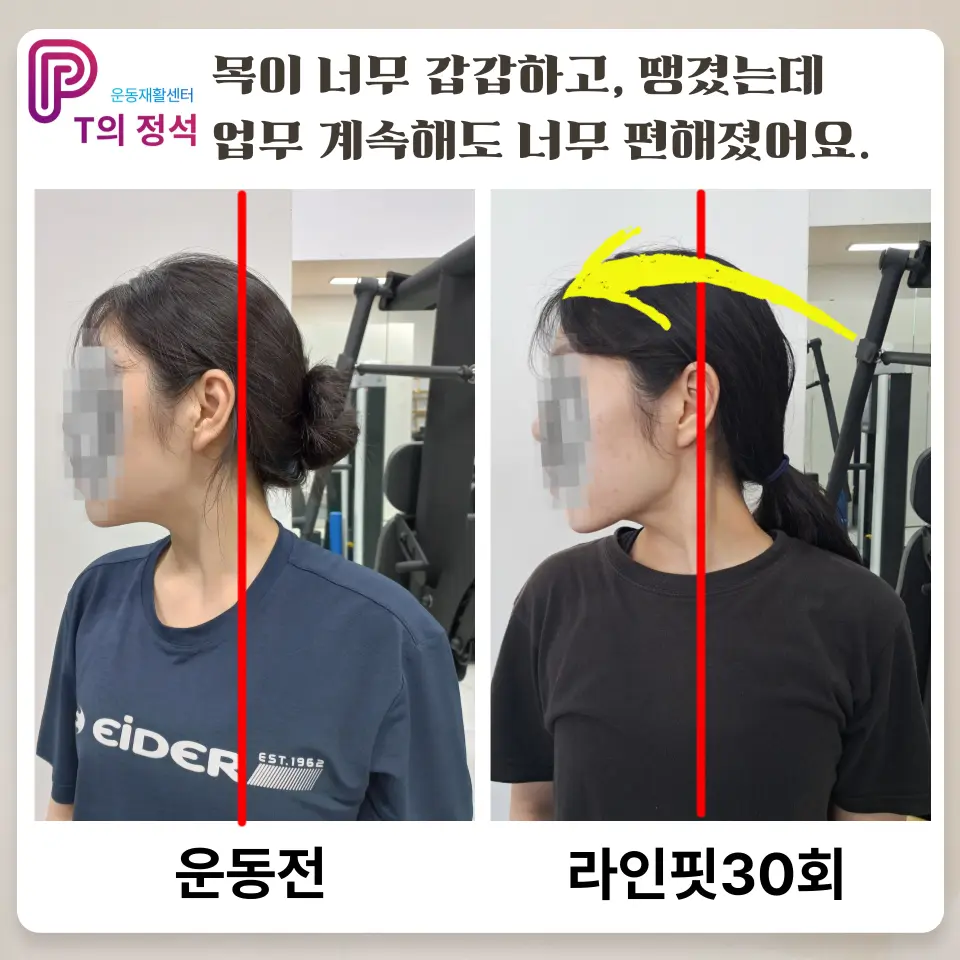 이미지 16