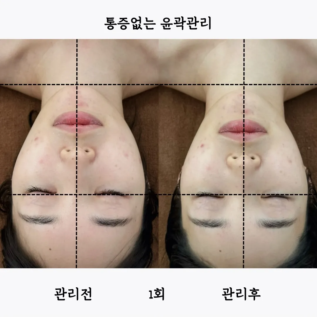 이미지 3
