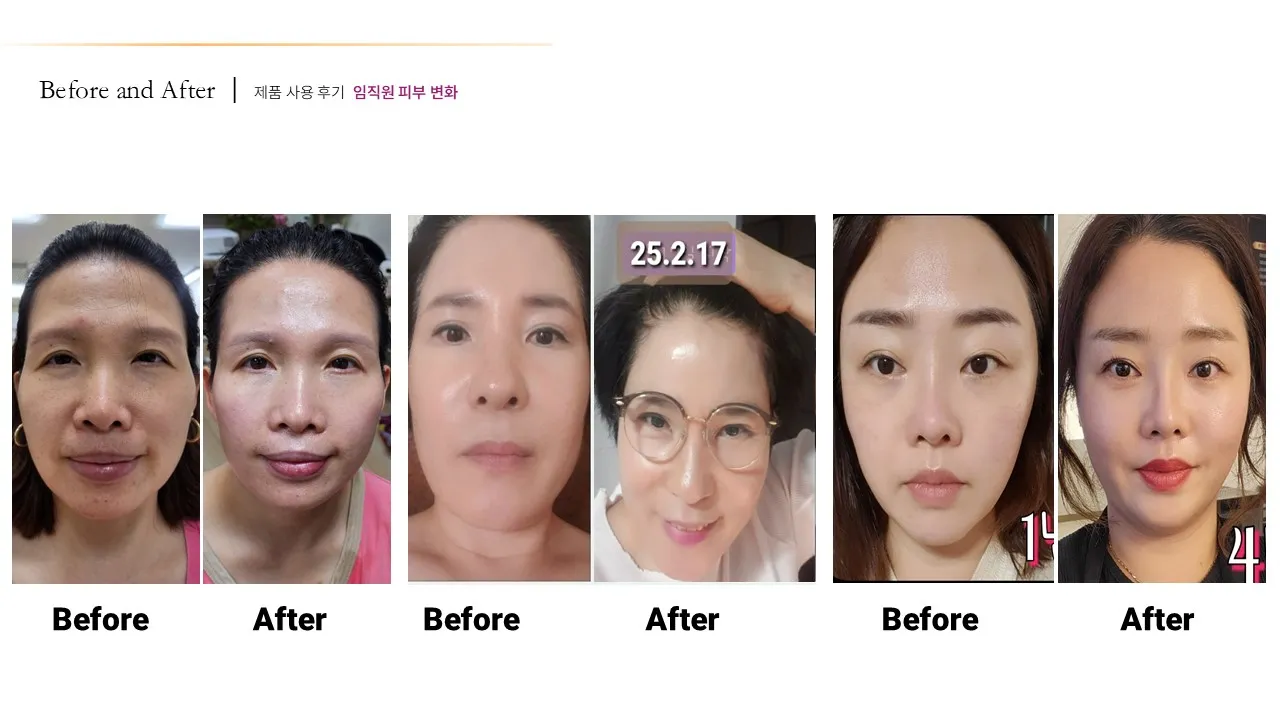 이미지 20