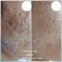 의정부 피부전문 샵 이레