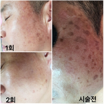 사용자 이미지