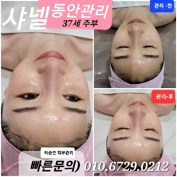 이승연 고수 프로필