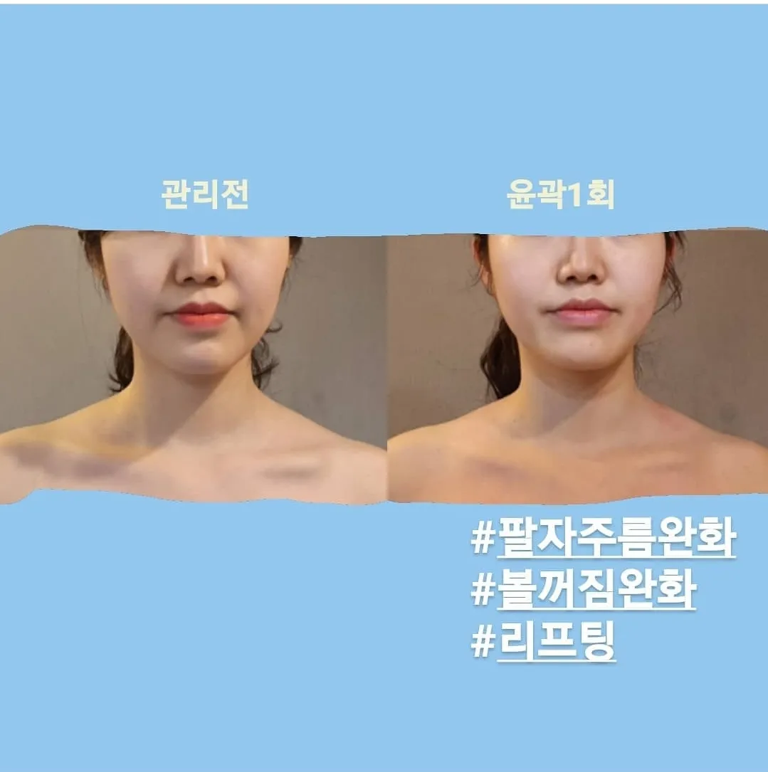 얼굴윤곽관리 얼굴경락관리 - 마켓 서비스 커머스 - 숨고, 숨은고수 얼굴윤곽관리 얼굴경락관리 - 마켓 서비스 커머스