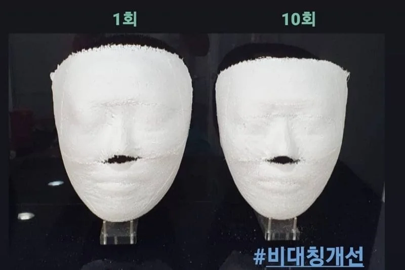 얼굴윤곽관리 얼굴경락관리 - 마켓 서비스 커머스 - 숨고, 숨은고수 얼굴윤곽관리 얼굴경락관리 - 마켓 서비스 커머스